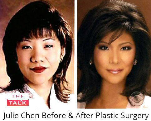 Julie Chen Before and After Plastic Surgery